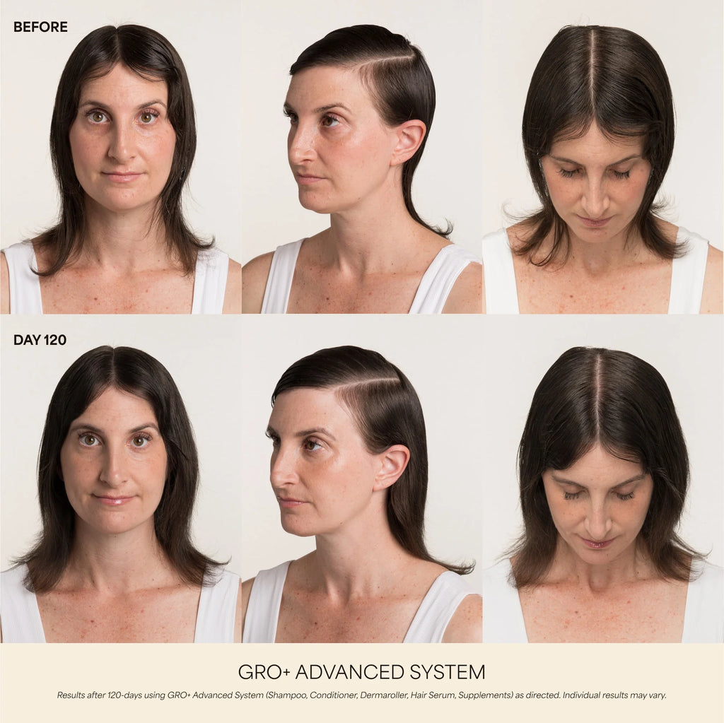 GRO+ Advanced Hair Serum