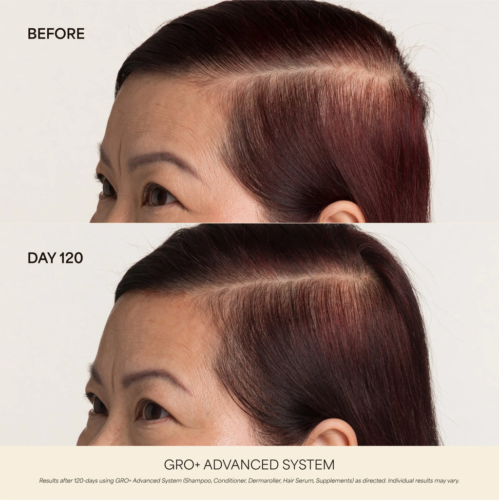 GRO+ Advanced Hair Serum