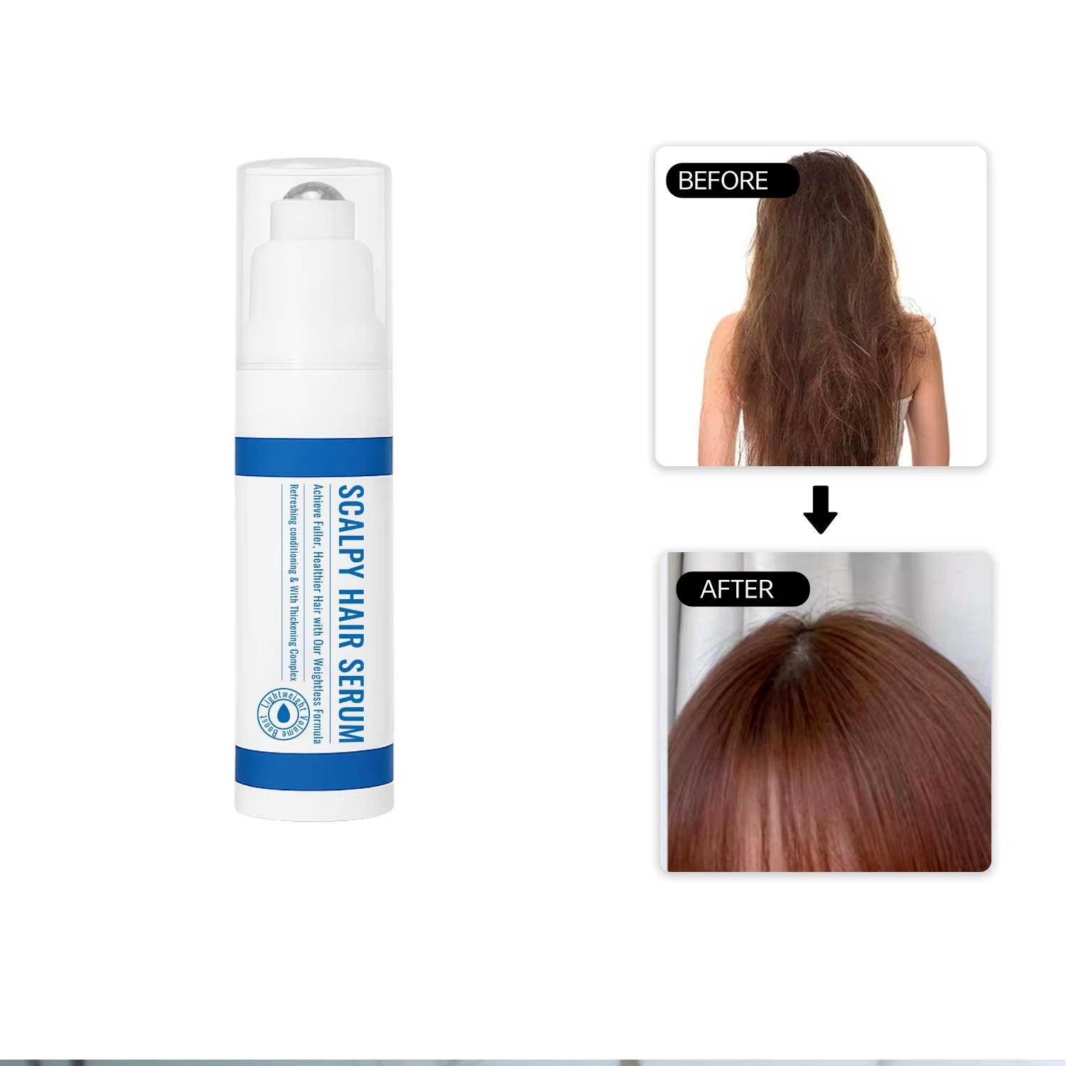 15ML Scalpy Hair Growth Serum for Men & Women Scalp Treatment Non-Greasy Lightweight Hair Care Serum for Hair Loss & Thinning
