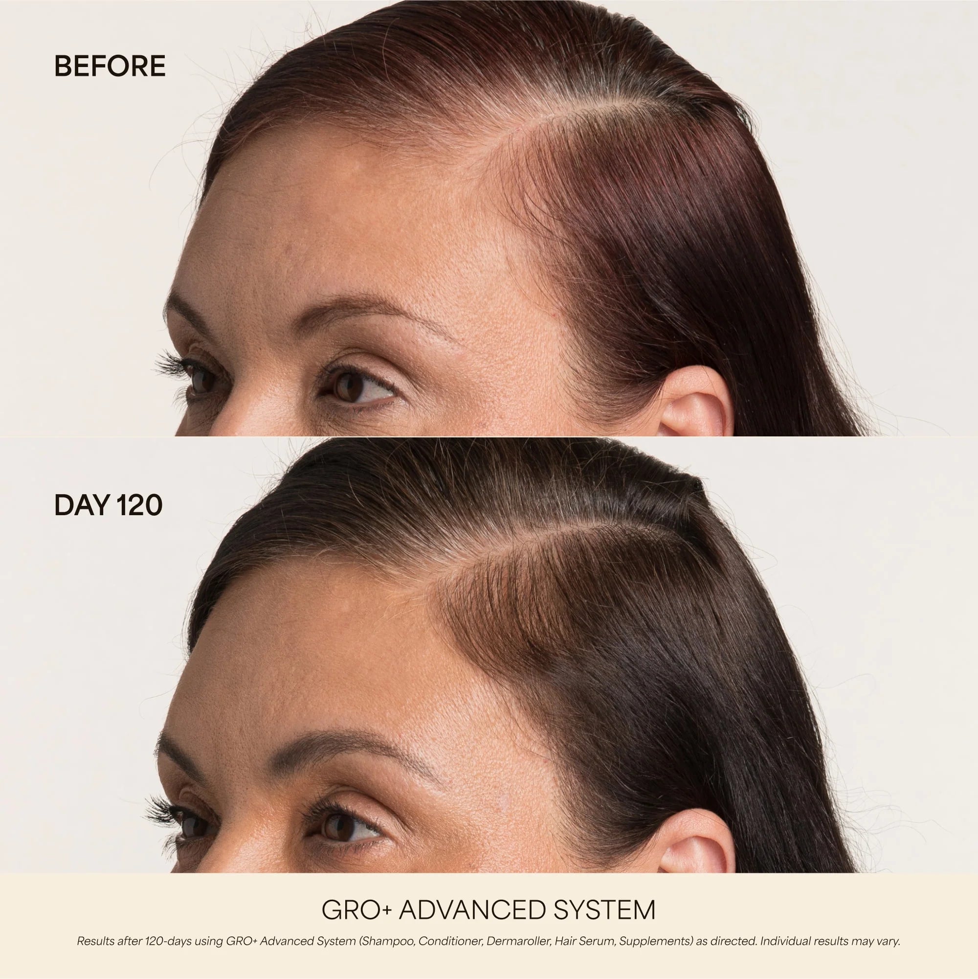GRO+ Advanced Hair Serum